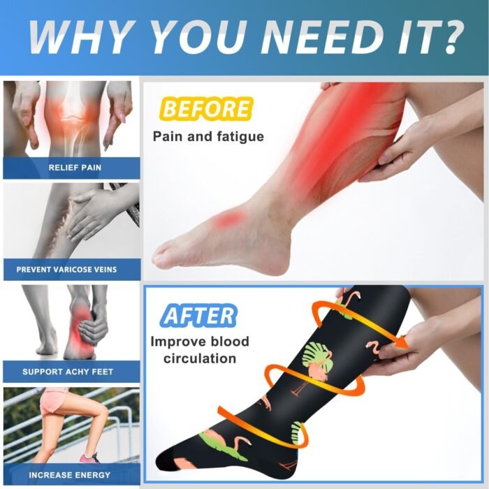 Aoliks Medical Compression Socks for Women & Men, Support Knee High Socks for Running,Nurses,Travel - Image 2