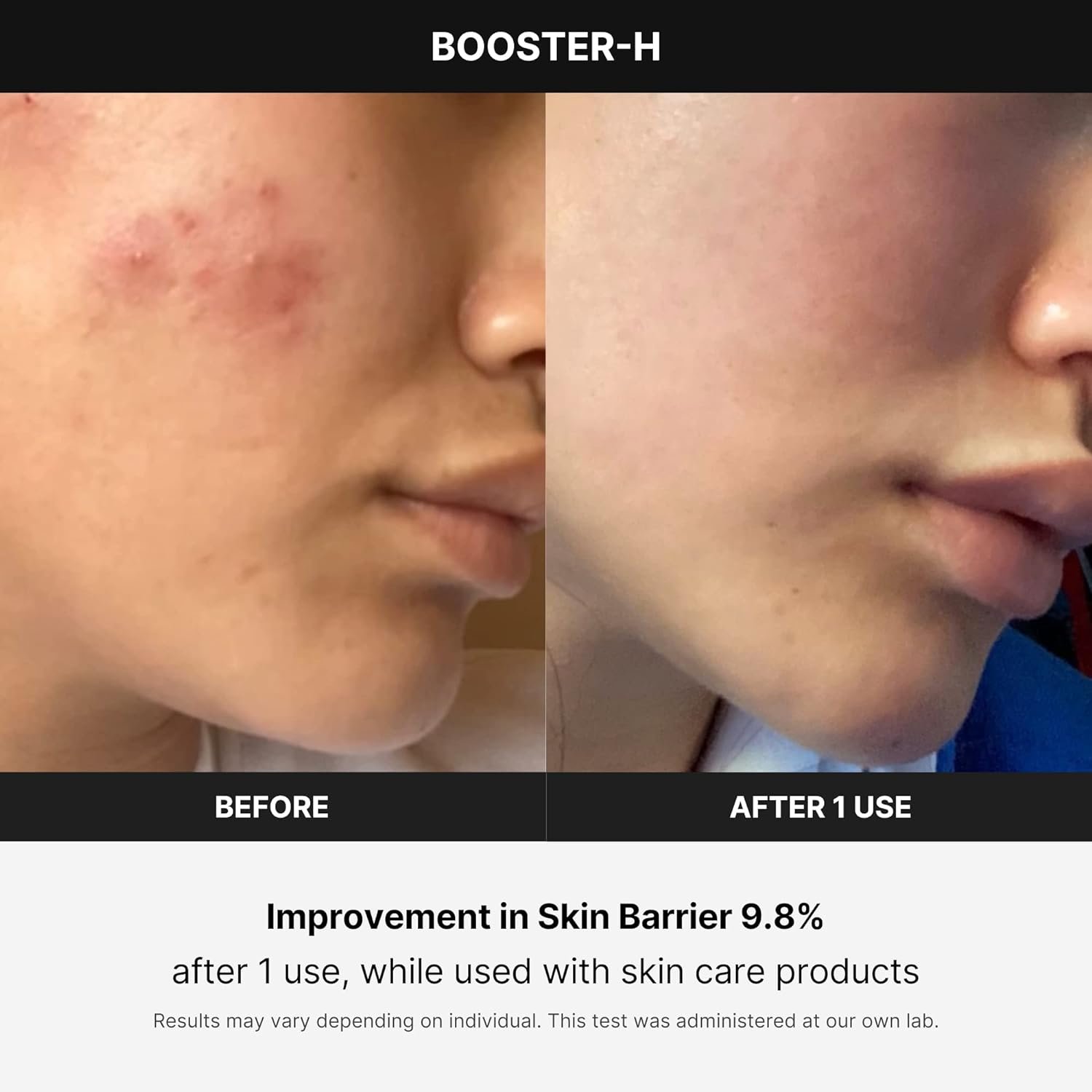 Medicube Age-R Booster H - Korean No.1 Skin Care Device - Facial Glow Booster for Maximizing and Boosting Skin Care Absorption - Needle Free - Image 4