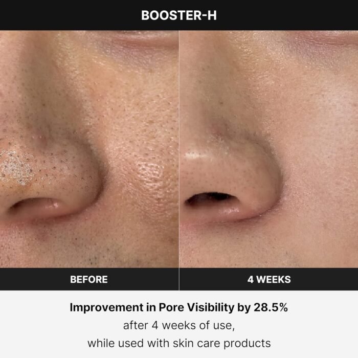 Medicube Age-R Booster H - Korean No.1 Skin Care Device - Facial Glow Booster for Maximizing and Boosting Skin Care Absorption - Needle Free - Image 5