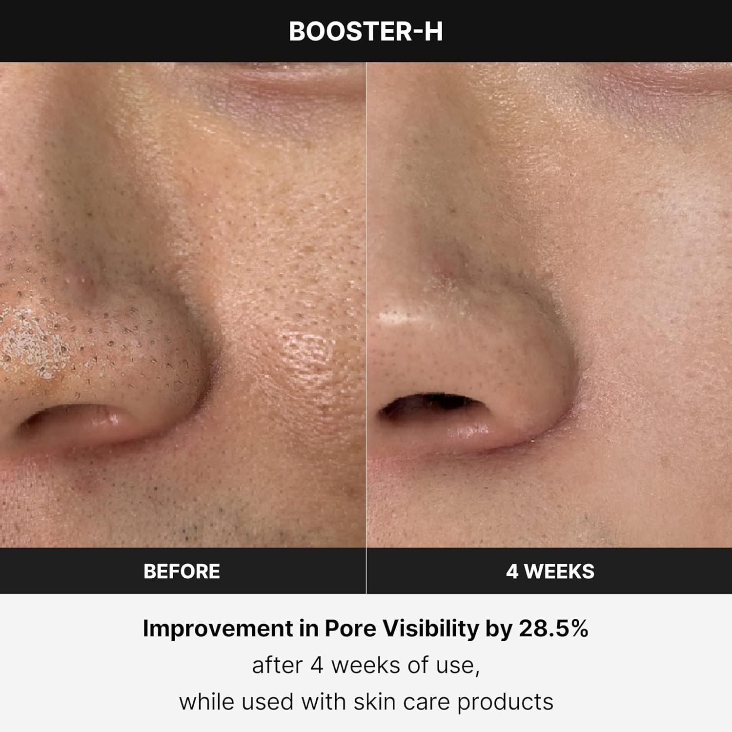 Medicube Age-R Booster H - Korean No.1 Skin Care Device - Facial Glow Booster for Maximizing and Boosting Skin Care Absorption - Needle Free - Image 5