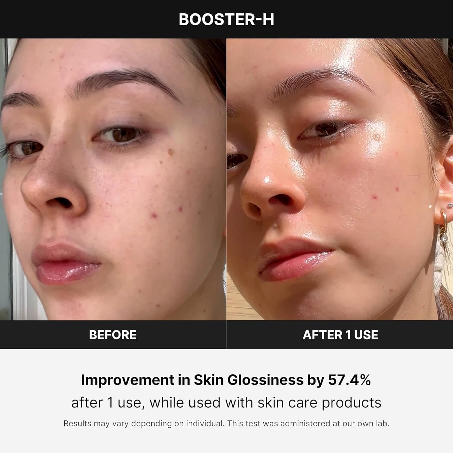 Medicube Age-R Booster H - Korean No.1 Skin Care Device - Facial Glow Booster for Maximizing and Boosting Skin Care Absorption - Needle Free - Image 3